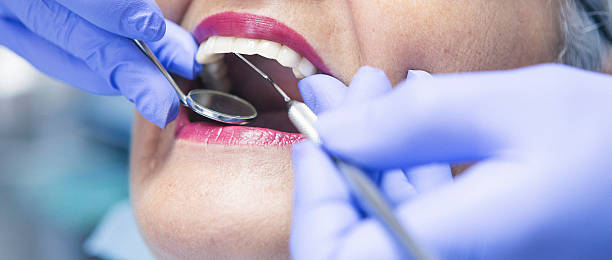 Best Emergency Tooth Extraction in Norton, KS